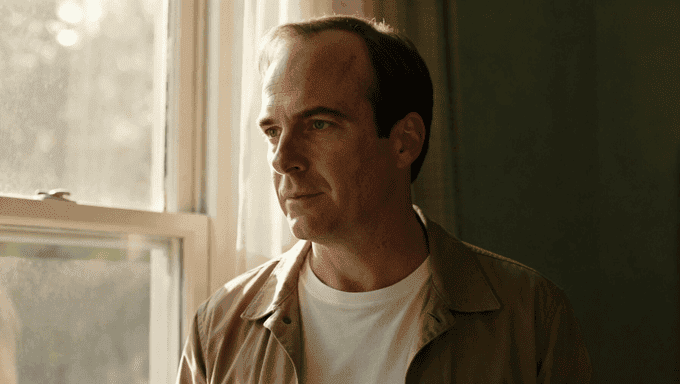 Come impostare correttamente il primo infoltimento capelli uomo